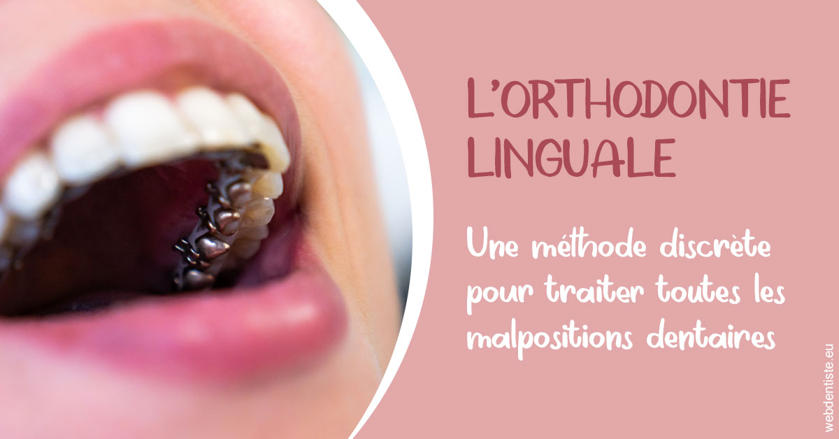 https://dr-bricout-anne-emmanuelle.chirurgiens-dentistes.fr/L'orthodontie linguale 2