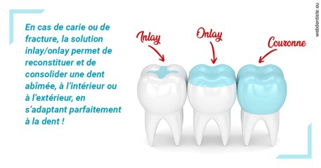 https://dr-bricout-anne-emmanuelle.chirurgiens-dentistes.fr/L'INLAY ou l'ONLAY