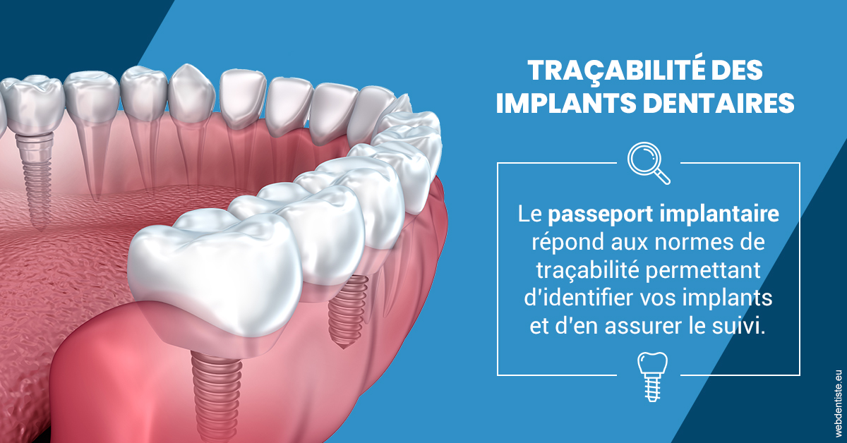 https://dr-bricout-anne-emmanuelle.chirurgiens-dentistes.fr/T2 2023 - Traçabilité des implants 1