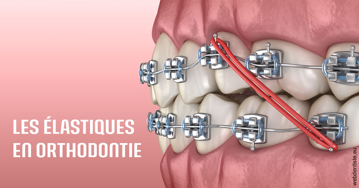 https://dr-bricout-anne-emmanuelle.chirurgiens-dentistes.fr/Elastiques orthodontie 2